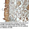 TRUB2 Antibody