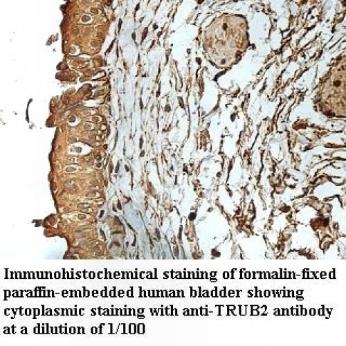 TRUB2 Antibody