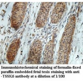 TSSK6 Antibody