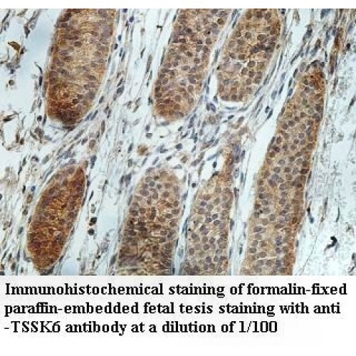 TSSK6 Antibody