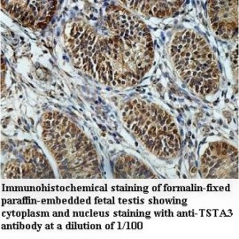 TSTA3 Antibody