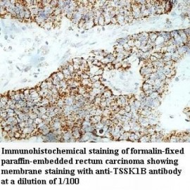 TSSK1B Antibody