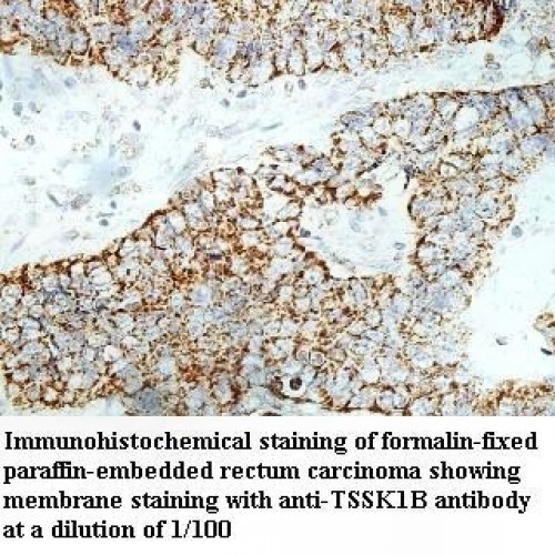 TSSK1B Antibody