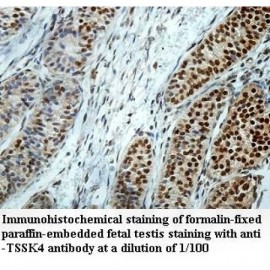 TSSK4 Antibody