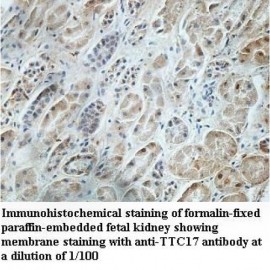 TTC17 Antibody