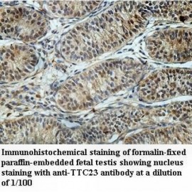 TTC23 Antibody