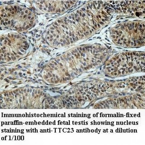 TTC23 Antibody