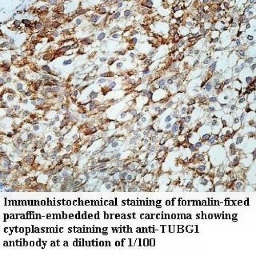 TUBG1 Antibody