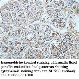 SUNC1 Antibody