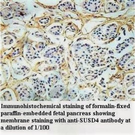 SUSD4 Antibody