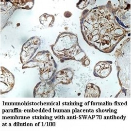 SWAP70 Antibody