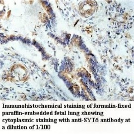 SYT6 Antibody