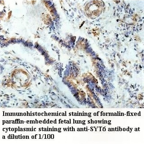 SYT6 Antibody