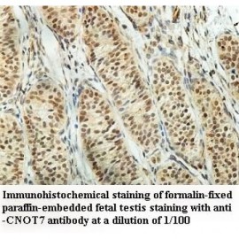 CNOT7 Antibody