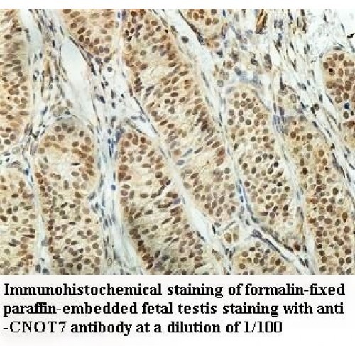 CNOT7 Antibody
