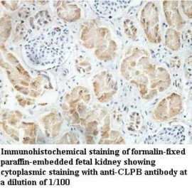 CLPB Antibody