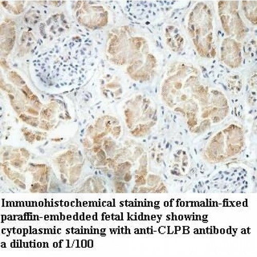 CLPB Antibody