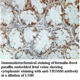 TRIM60 Antibody