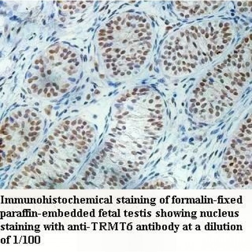 TRMT6 Antibody