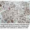 TRPC4AP Antibody