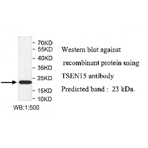 TSEN15 Antibody