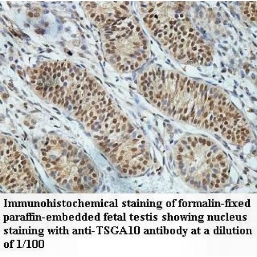 TSGA10 Antibody