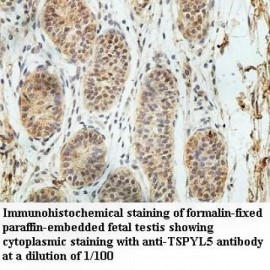 TSPYL5 Antibody