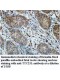 TTC23L Antibody