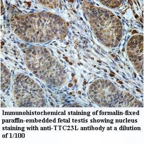 TTC23L Antibody