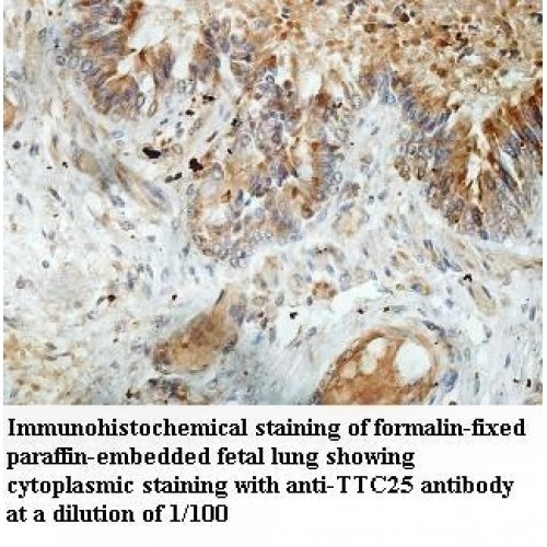 TTC25 Antibody