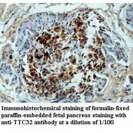 TTC32 Antibody