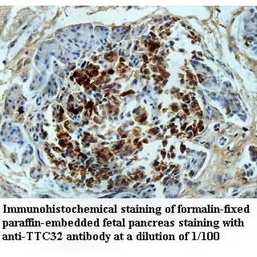 TTC32 Antibody