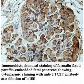 TTC27 Antibody