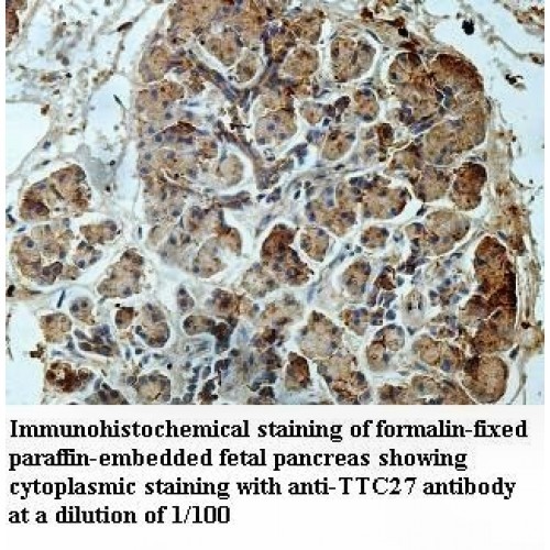 TTC27 Antibody