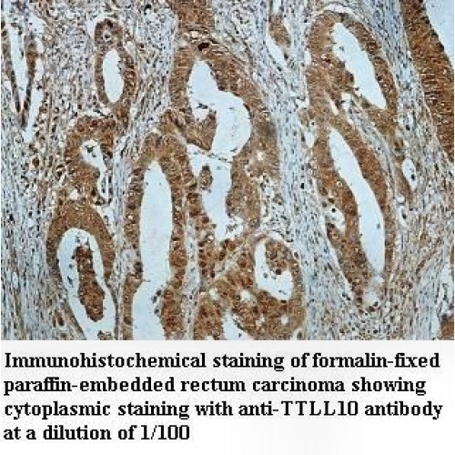 TTLL10 Antibody