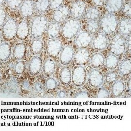 TTC38 Antibody