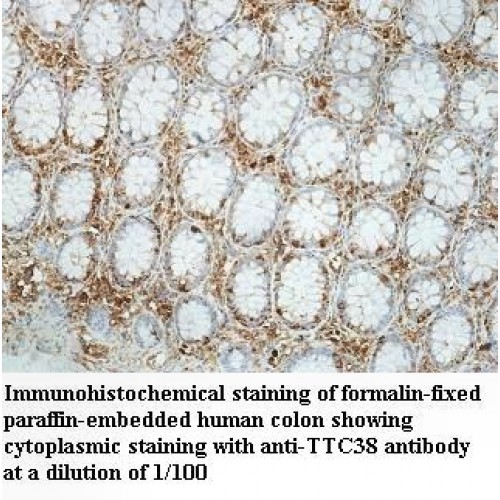 TTC38 Antibody