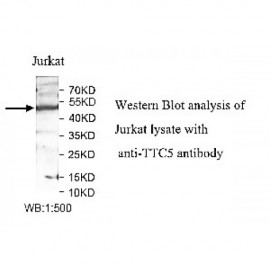 TTC5 Antibody