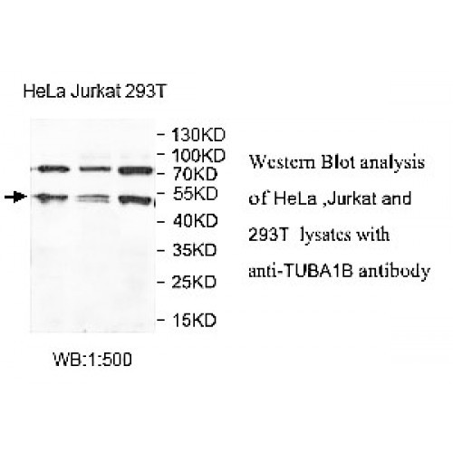 TUBA1B Antibody