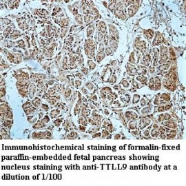 TTLL9 Antibody