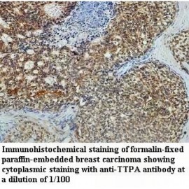TTPA Antibody
