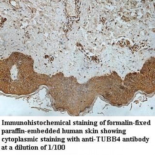 TUBB4 Antibody