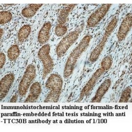 TTC30B Antibody