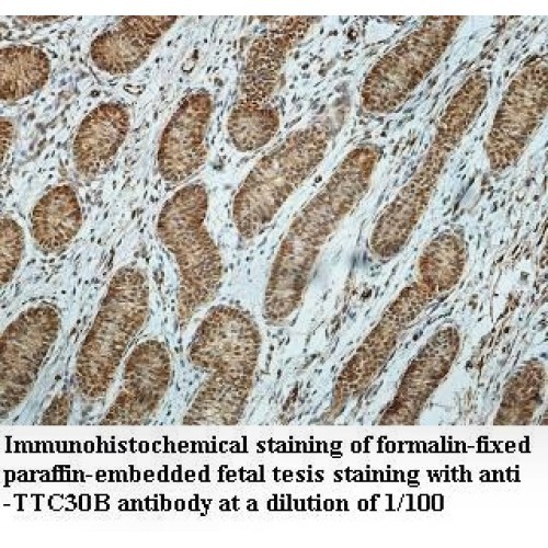 TTC30B Antibody