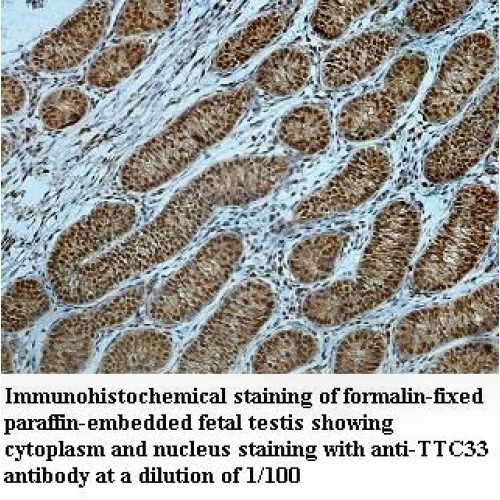 TTC33 Antibody