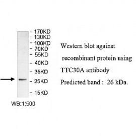 TTC30A Antibody