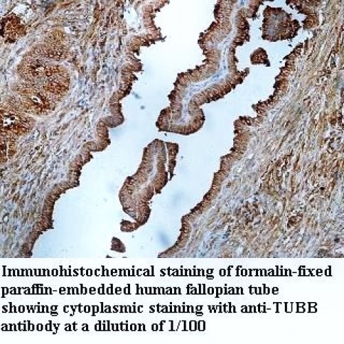 TUBB Antibody