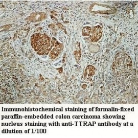 TTRAP Antibody