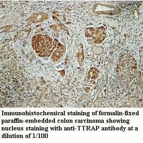TTRAP Antibody