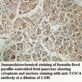 TUSC4 Antibody
